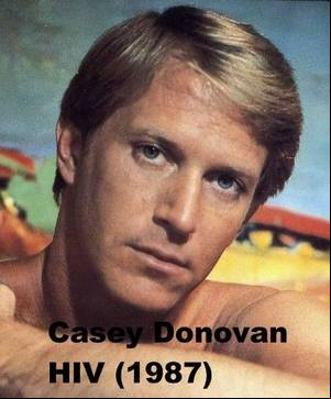 28 Year Old Stars - Casey DONOVAN-John CalvinCulver related pulmonary infection,Years Active  around 28 years old),Height